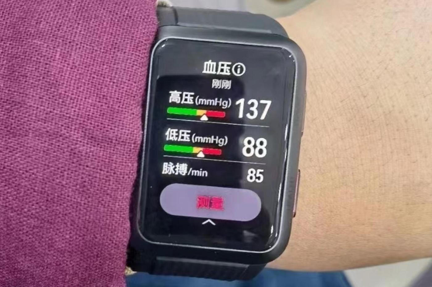 Cette montre Xiaomi peut réaliser des électrocardiogramme et mesurer votre  tension