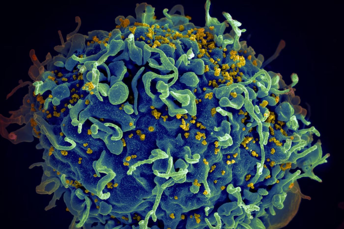 Le VIH (en jaune) en train d'infecter une cellule humain.