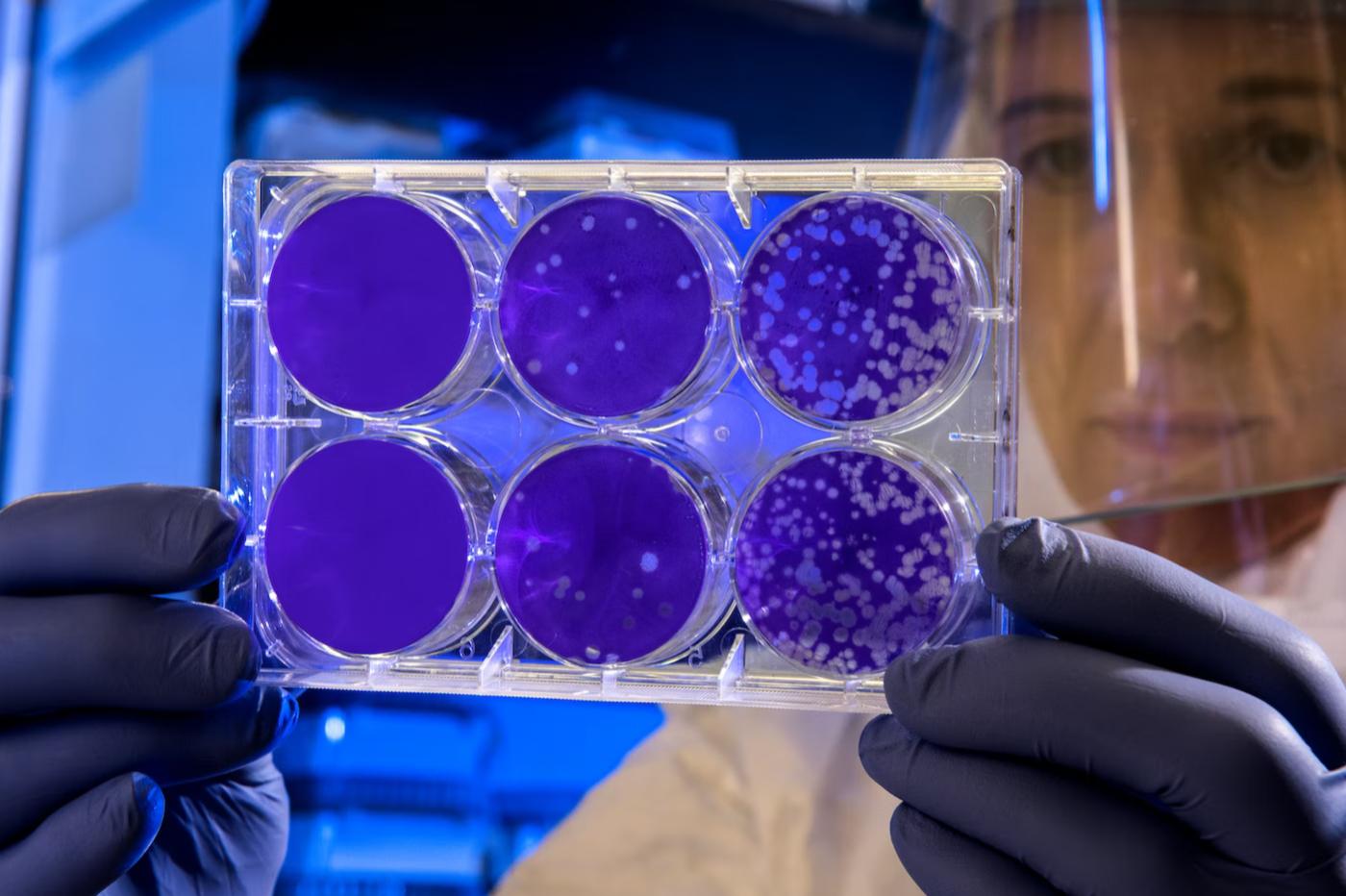 un chercheur observe des cultures de microorganismes dans des boîtes de petri