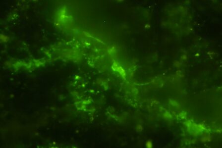 Microbes Afrique Du Sud
