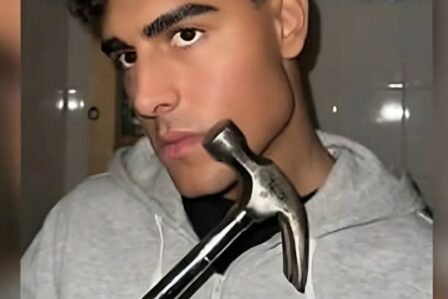 Bone Smashing