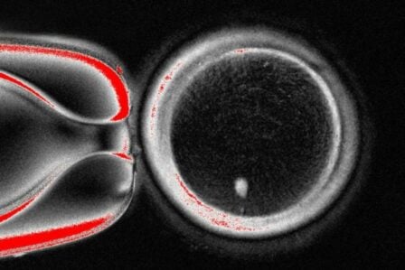Cellule Somatique Reprogrammée