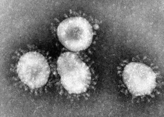 Le coronavirus, le vecteur du virus du SRAS. 