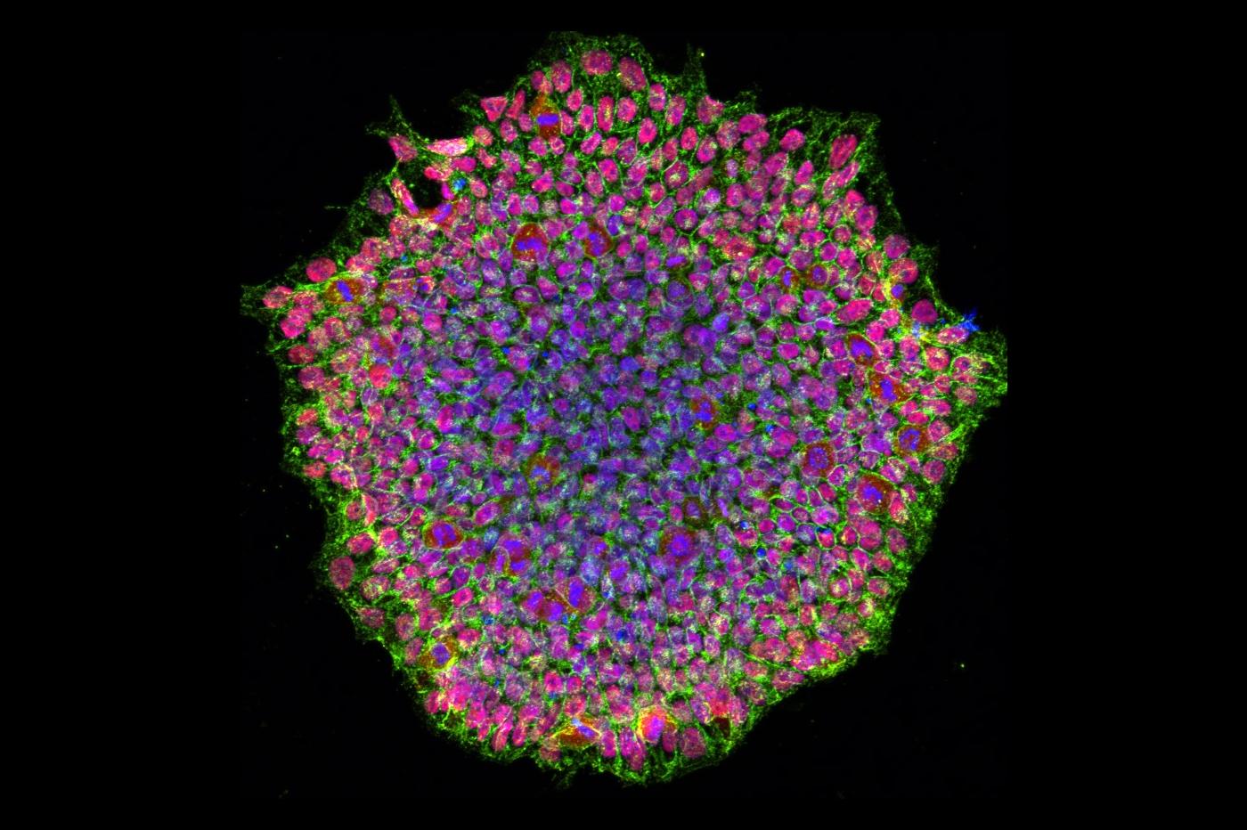 des cellules souches pluripotentes induites